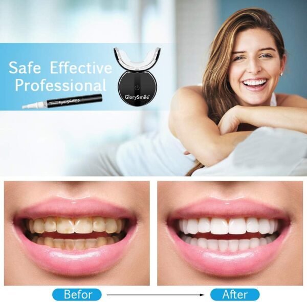 Glory Smile Teeth Whitening Kit with LED Light